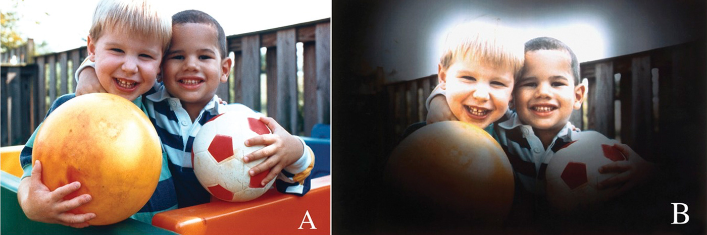 kuidas glaukoomiga inimesed näevad